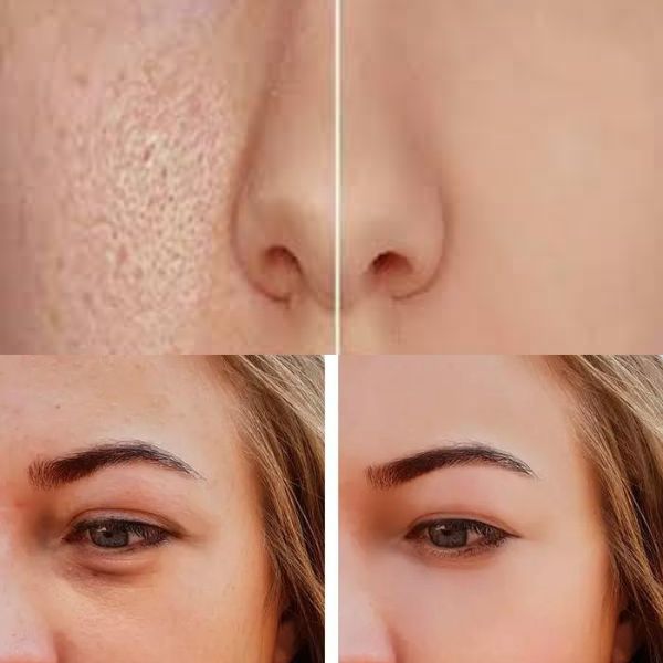 GLACIE glødende hud